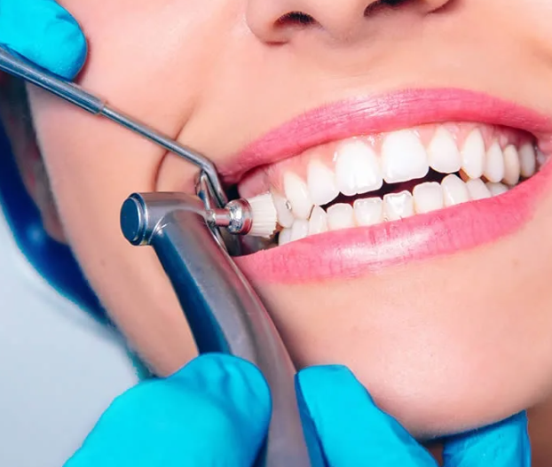 Почему профессиональная чистка зубов важна для каждого - фотография